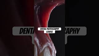 Dental photography course #dentists #dentist #dental #dentalcare #dentalhygiene #dentistry #caries