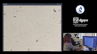 PRÁCTICA 15. EXAMEN MICROSCÓPICO DE LA ORINA. screenshot 2