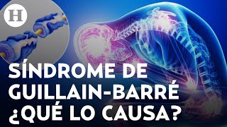 ¿Por qué hay alerta epidemiológica en Tlaxcala ante casos de Síndrome de Guillain-Barré?