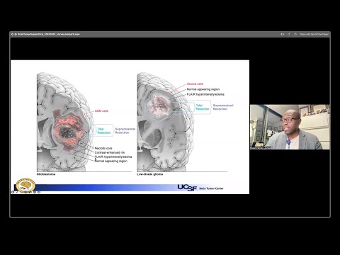 Advances in Surgical Strategies for Brain Cancer | Shawn Hervey-Jumper, MD