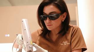 Spider Vein Removal at Skin City Lab Manhattan | Smooth, Clear & Confident Skin