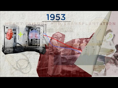 An Animated History of Heart Transplantation