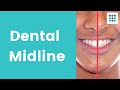 DENTAL MIDLINE SHIFT: What, why, and how to correct l Dr. Bailey