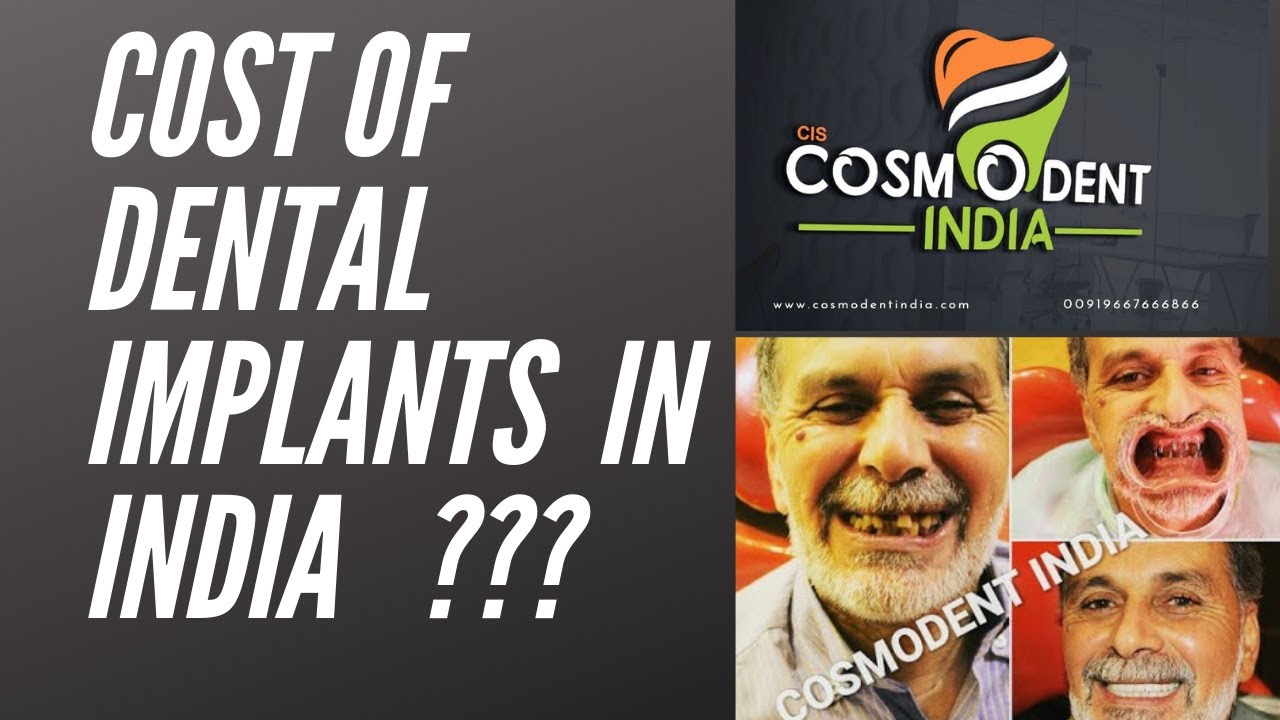 How to find cost of dental implant in India YouTube