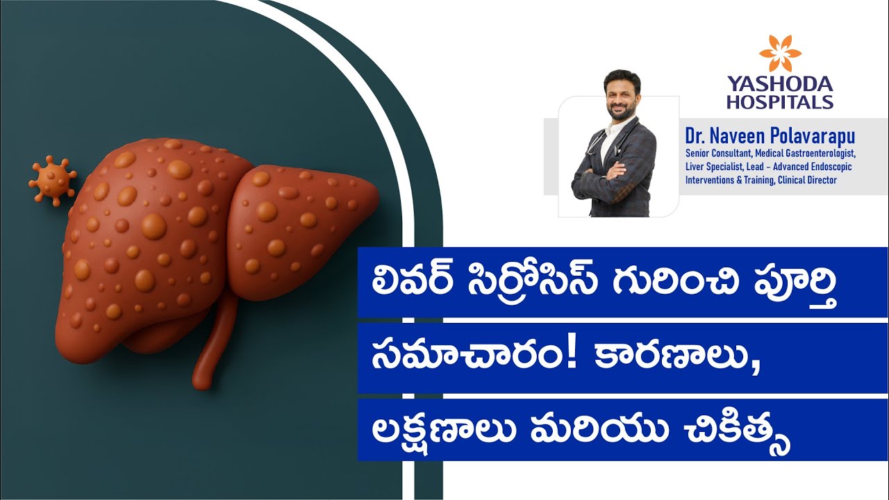 లివర్ సిర్రోసిస్ అంటే ఏమిటి? కారణాలు, లక్షణాలు, చికిత్స | డా. నవీన్ పోలవరపు