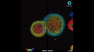 Label-free Observation of Organoid Growth