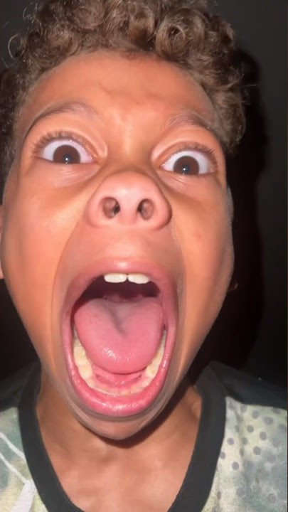 Terrifying Sleepwalking Incident Caught on Camera!  😳😳😳