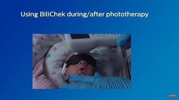 Using Philips BiliChek During/After Phototherapy