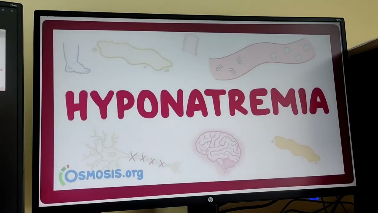 Suv va natriy balansi. Infuzion terapiya asoslari. #hyponatremia #hypernatremia #dehydration #вода
