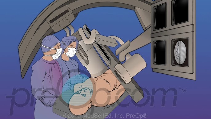 Angioplasty & Stenting | Medical Animation - YouTube