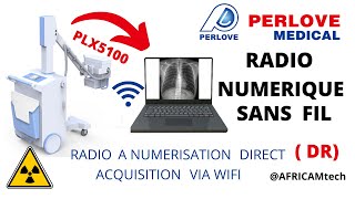 APPAREIL DE RADIO AVEC DÉTECTEUR A NUMÉRISATION DIRECT DR:  PLX5100 PERLOVE MEDICAL screenshot 5