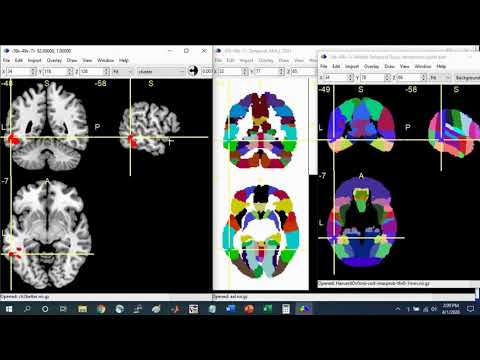 MRIcron Brain Region of Interest (ROI) Guide Part 1