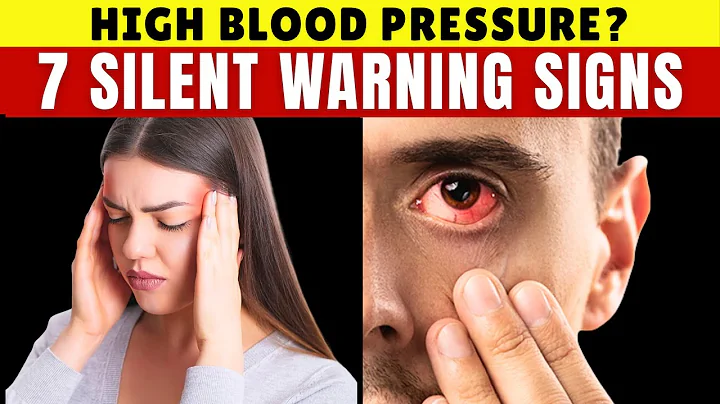 7 Simple Signs of High Blood Pressure You MUST Know