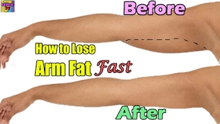 How to Lose Arm Fat Fast | Home Exercise Arm Fat Lose - 2017 NEW