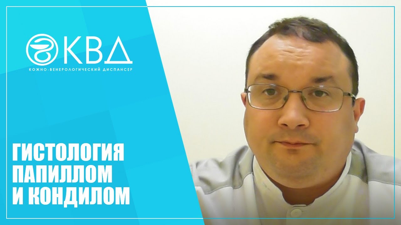1226 Гистология папиллом и кондилом