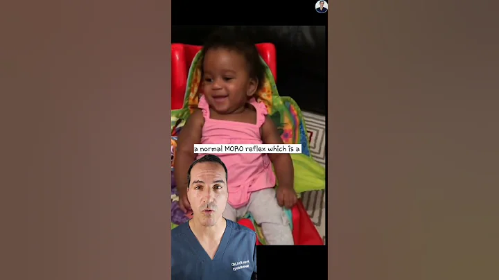 Are you Aware of THIS Shocking Childhood Epilepsy?! #shorts