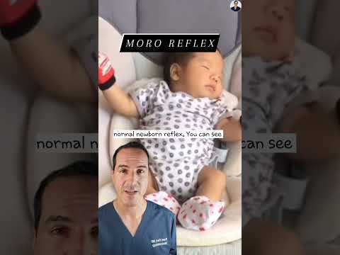 Video: Pominú infantilné kŕče?