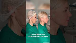 Альтернатива пластической операции в нашей клинике без наркоза и операции! -10 лет🔥 Интересно?