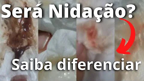 Quantos dias antes da menstruação pode ocorrer a nidação?