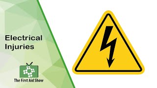 Electrical injuries on The First Aid Show