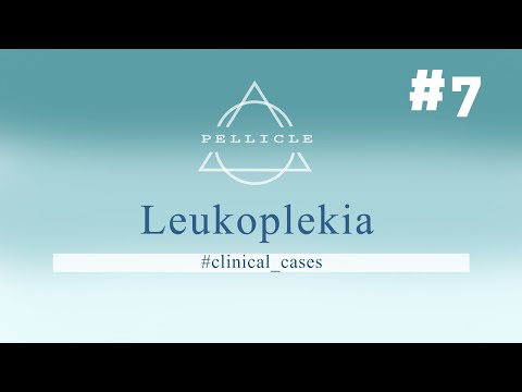 Leukoplekia