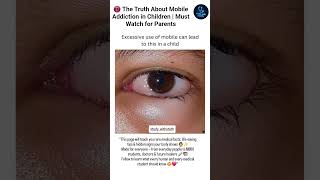 Excessive Mobile Use Can Harm Children Parenting Awareness