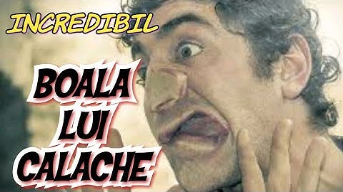 Viața și boala lui CALACHE, o poveste impresionantă!