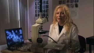 Live Blood Ysis After Drinking Kangen Hydrogen Water You Wont Believe This