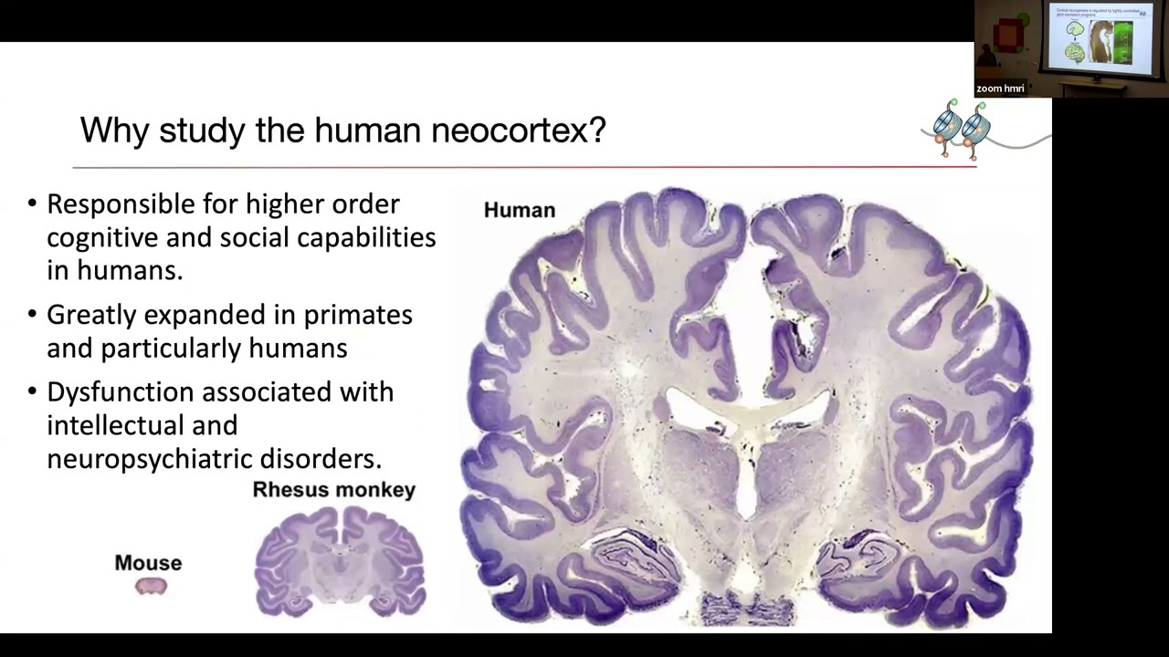 Insights of molecular mechanisms of cortical development & Down syndrome; single-cell multi-omics