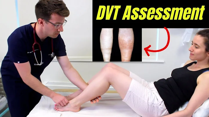 Deep Vein Thrombosis (DVT) OSCE Clinical Examination | Plus DVT risk factors, diagnosis & treatment - DayDayNews