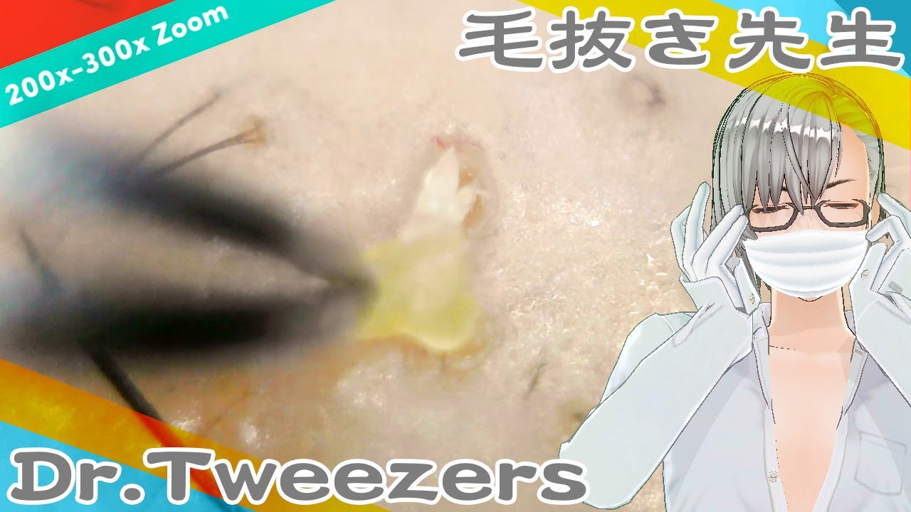 194 0x Zoom Whether To Pull Or Push Dr Tweezers 毛抜き先生の角栓や毛根 Youtube