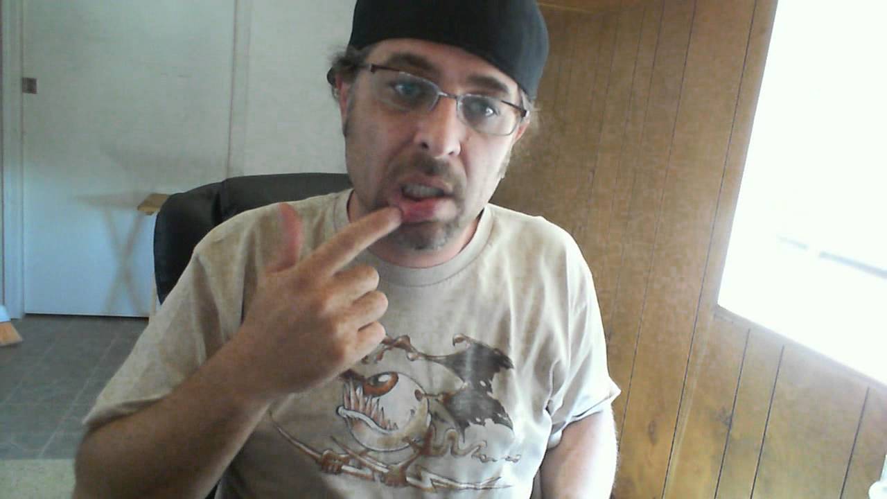 Chipped Tooth and Melting Tongue YouTube