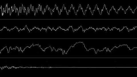 [Amiga MOD] Firefox & Tip - Hyperbased - Oscilloscope View