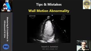 Tips & Mistakes: Wall Motion