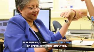 FDA approves first-in-human trial for neural-enabled prosthetic hand system developed at FIU
