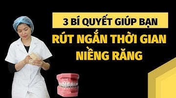 3 Bí Quyết Giúp Bạn Rút Ngắn Thời Gian Niềng Răng | bác sĩ Tuấn Nha Khoa Sao Việt