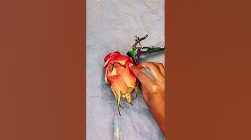 The paracervical block.