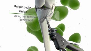 Exoshape Introduction Animation.wmv