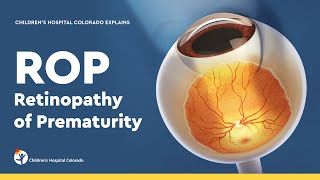 Retinopathy of Prematurity: Diagnosis and Treatment