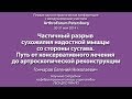 Частичный разрыв сухожилия надостной мышцы со стороны сустава