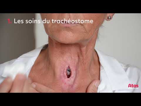 Vidéo: Formation De La Couronne Shaffler (10 Photos): Comment La Tailler Pour La Splendeur Et Comment La Pincer? Règles De Soins De Suivi