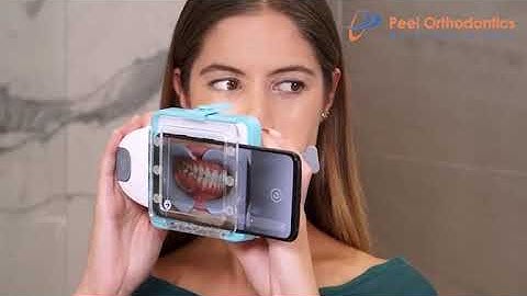 How to use DM ScanBox