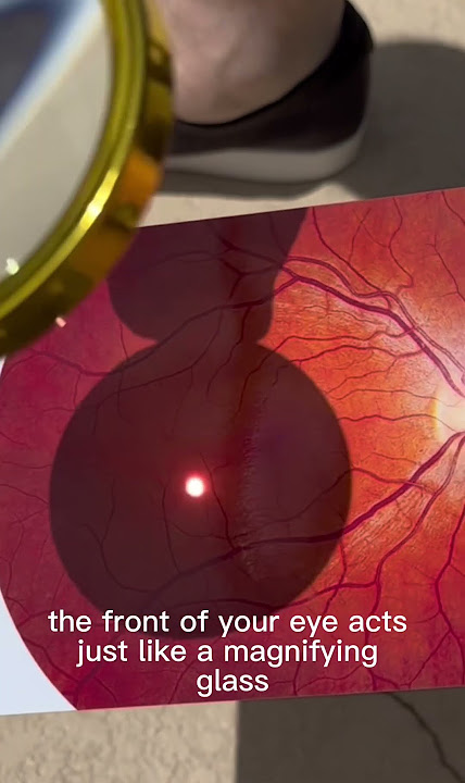 This is what happens if you stare at the SUN