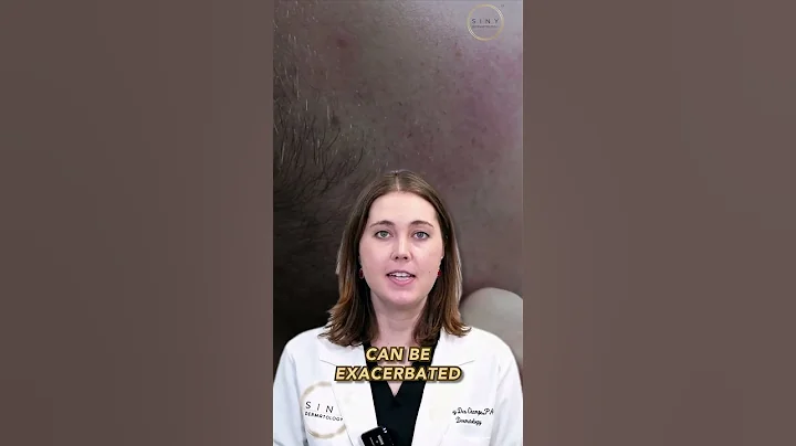 What causes FUNGAL ACNE?