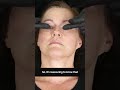 Are you familiar with the anatomy of the nose? In this informative clip, I&#39;ll guide you through the