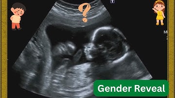 Baby Boy or Baby Girl ? 22 weeks ultrasound video