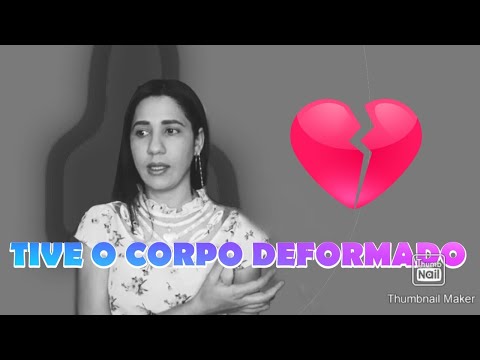 Vídeo: Os fãs não reconheceram Priluchny após a cirurgia plástica e o confundiram com Dava