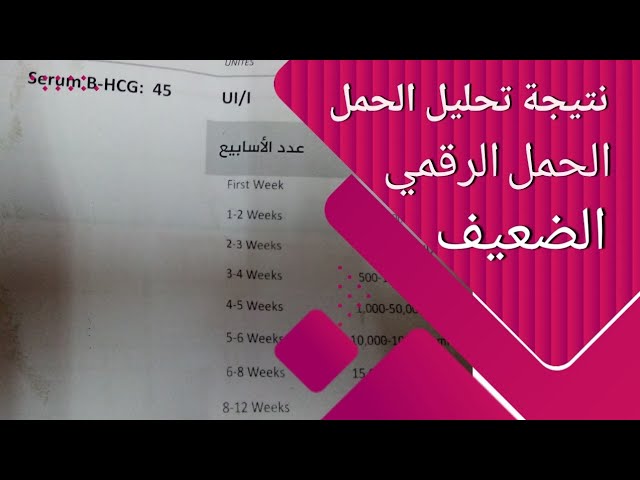 ڊجيٽل تجزيي ۾ ڪمزور لوڊ جو سيڪڙو ڇا آهي؟