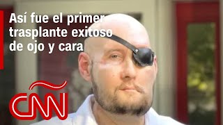 El Dr. Huerta explica cómo se hizo el primer trasplante de ojo y cara