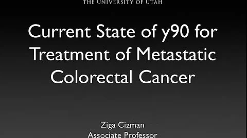 Current State of y90 for Treatment of Metastatic Colorectal Cancer